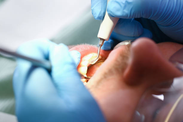 Best Cracked Tooth Emergency Dentist  in Bridgeport, AL
