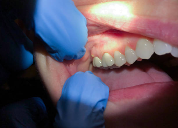 Best Urgent Tooth Repair  in Bridgeport, AL