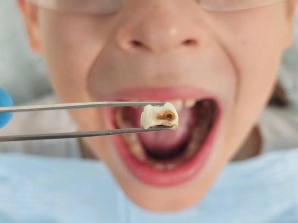 Best Tooth Infection Emergency Dentist  in Bridgeport, AL